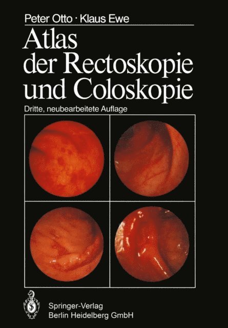 K. Ewe, P. Otto - Atlas der Rectoskopie und Coloskopie, E-bok