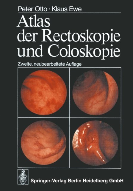 K. Ewe, P. Otto - Atlas der Rectoskopie und Coloskopie, E-bok