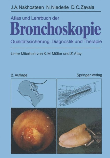 Donald C. Zavala, Norbert Niederle, John A. Nakhosteen - Atlas und Lehrbuch der Bronchoskopie, E-bok