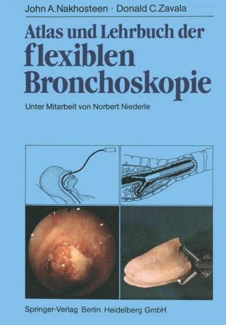 D.C. Zavala, J.A. Nakhosteen - Atlas und Lehrbuch der Bronchoskopie, E-bok