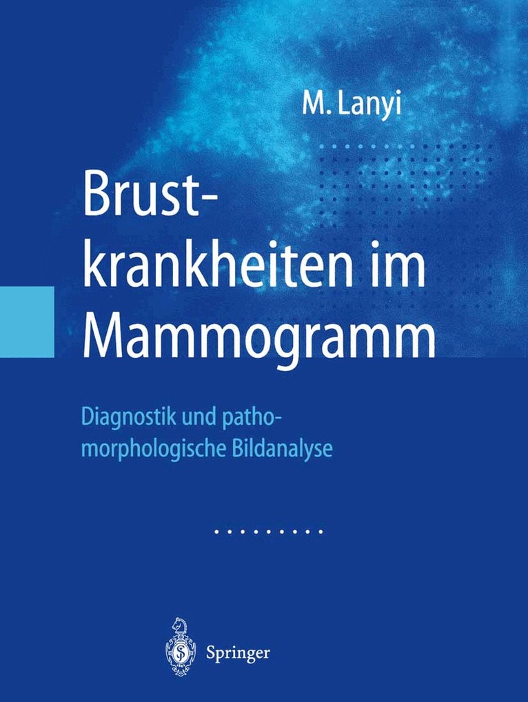 Marton Lanyi - Brustkrankheiten im Mammogramm, Häftad