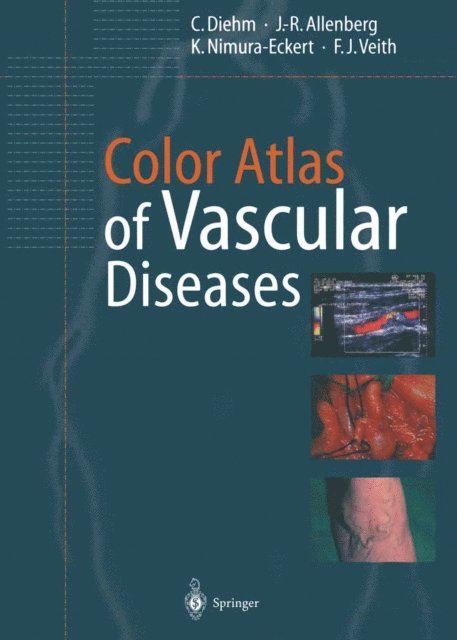 F.J. Veith, K. Nimura-Eckert, J.-R. Allenberg, C. Diehm - Color Atlas of Vascular Diseases, E-bok