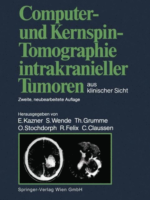 Claus Claussen, Roland Felix, Otto Stochdorph, Thomas Grumme, Sigurd Wende, Ekkehard Kazner - Computer- und Kernspin-Tomographie intrakranieller Tumoren aus klinischer Sicht, E-bok