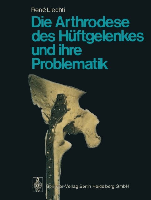 R. Liechti - Die Arthrodese des Hüftgelenkes und ihre Problematik, E-bok