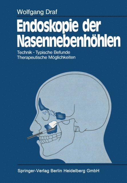 Wolfgang Draf - Endoskopie der Nasennebenhöhlen, E-bok