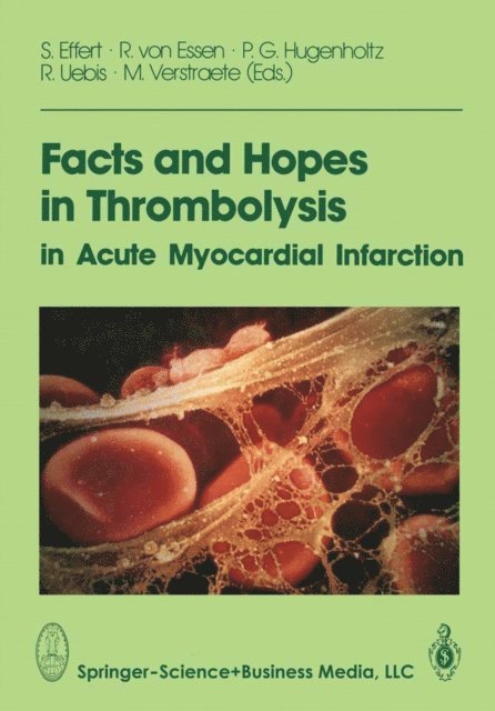 S. Effert - Facts and Hopes in Thrombolysis in Acute Myocardial Infarction, E-bok
