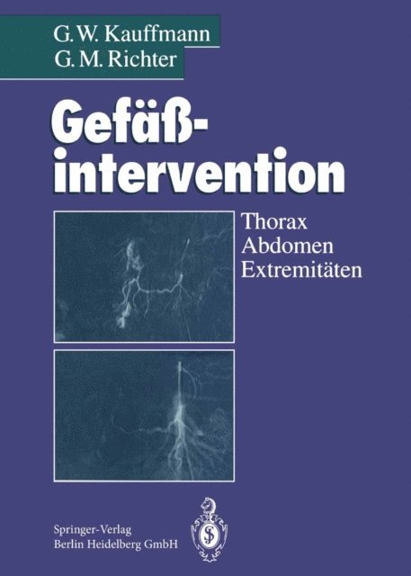 G.M. Richter, G.W. Kauffmann - Gefäßintervention, E-bok