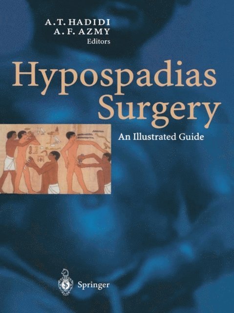 Montgomery David A., Ahmed Hadidi - Hypospadias Surgery, E-bok