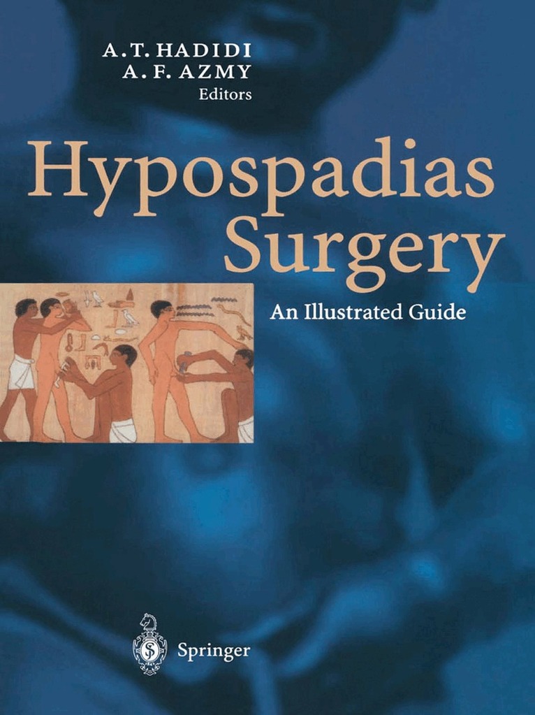 Ahmed Hadidi, Montgomery David A. - Hypospadias Surgery, Häftad