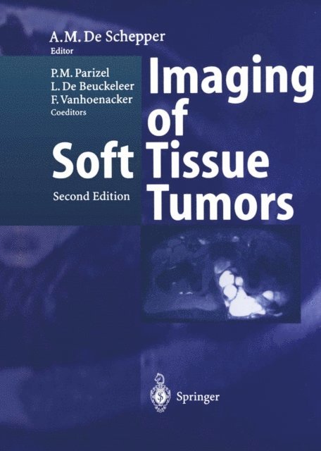 Arthur M. De Schepper - Imaging of Soft Tissue Tumors, E-bok