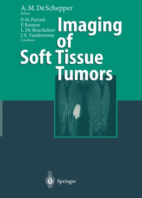 Jan E. Vandevenne, Luc DeBeuckeleer, Frank Ramon, Paul M. Parizel, Arthur M DeSchepper - Imaging of Soft Tissue Tumors, E-bok