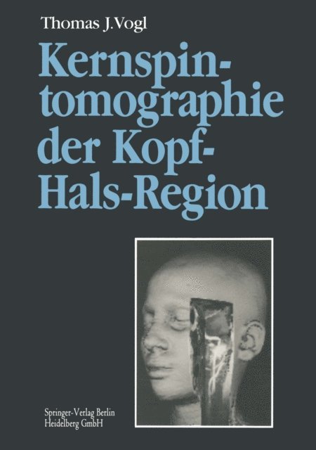 Thomas J. Vogl - Kernspintomographie der Kopf-Hals-Region, E-bok