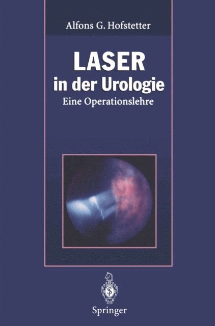 Alfons G. Hofstetter - Laser in der Urologie, E-bok
