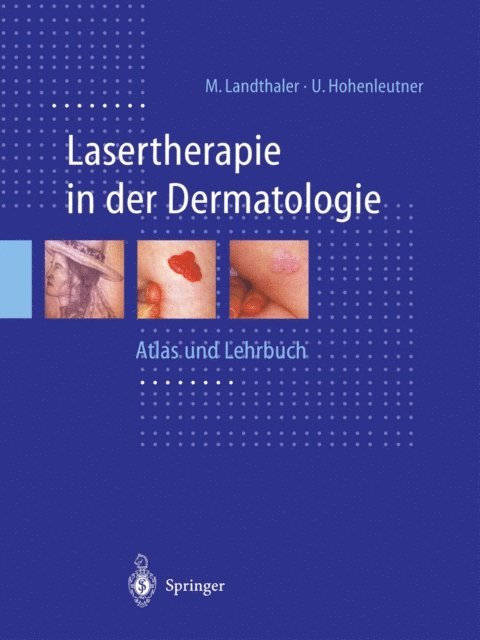 Ulrich Hohenleutner, Michael Landthaler - Lasertherapie in der Dermatologie, E-bok