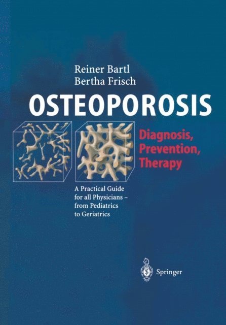 Bertha Frisch, Reiner Bartl - OSTEOPOROSIS, E-bok
