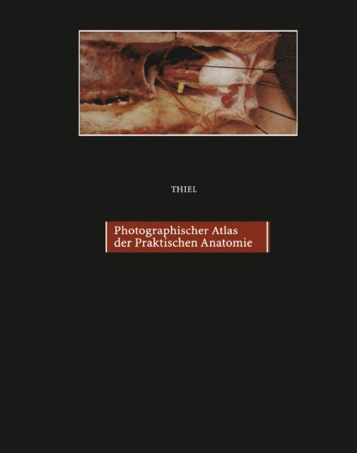 Walter Thiel - Photographischer Atlas der Praktischen Anatomie II, E-bok