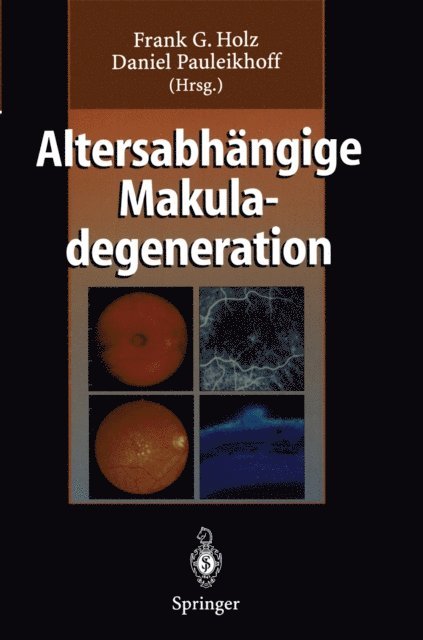 Daniel Pauleikhoff, Frank G. Holz - Altersabhängige Makuladegeneration, E-bok