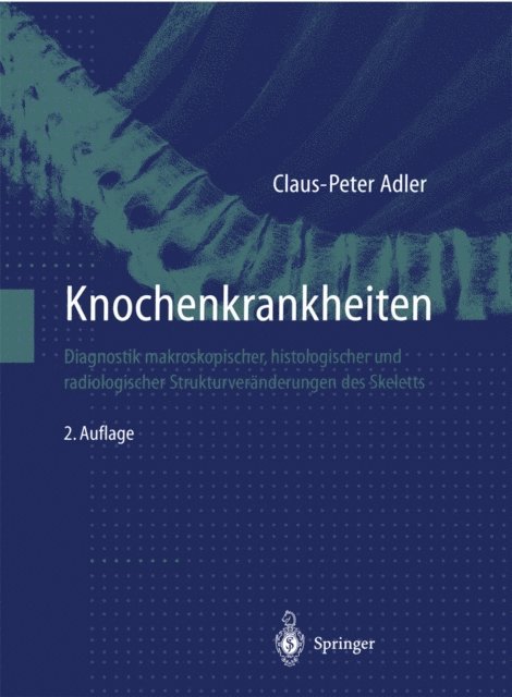 Claus-Peter Adler - Knochenkrankheiten, E-bok