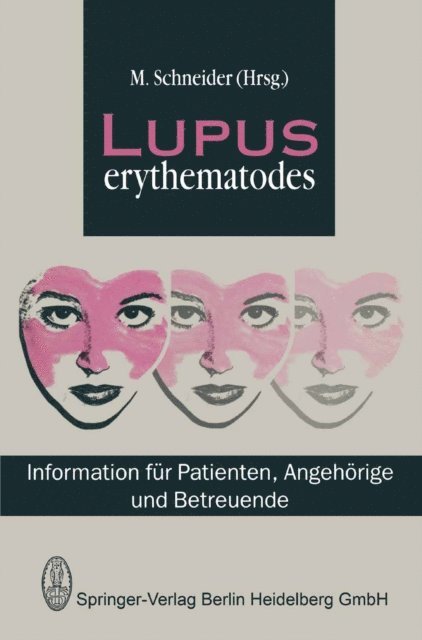 M. Schneider - Lupus Erythematodes, E-bok