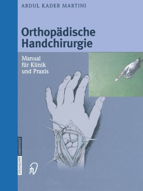 Abdul Kader Martini - Orthopädische Handchirurgie, E-bok. Tillgänglighet: Lägg i varukorg