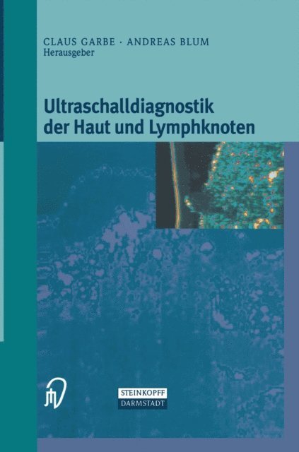 Andreas Blum, Klaus Garbe - Ultraschalldiagnostik der Haut und Lymphknoten, E-bok
