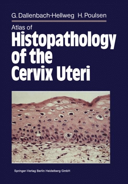 Marcus J. Trunk-Gemacher, Magnus von Knebel Doeberitz, Gisela Dallenbach-Hellweg - Atlas of Histopathology of the Cervix Uteri, E-bok