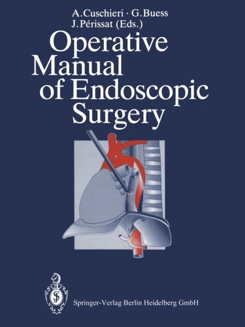 J. Perissat, G. Buess, A. Cuschieri - Operative Manual of Endoscopic Surgery, E-bok