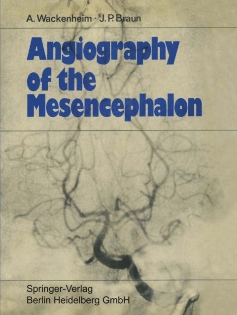 Jean Paul Braun, Auguste Wackenheim - Angiography of the Mesencephalon, E-bok