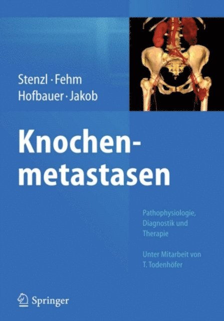 Franz Jakob, Lorenz C. Hofbauer, Tanja Fehm, Arnulf Stenzl - Knochenmetastasen, E-bok