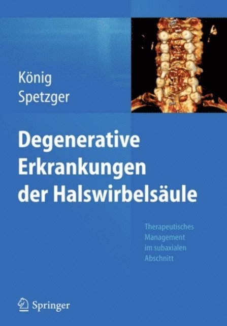 Uwe Spetzger, Stefan Alexander Konig - Degenerative Erkrankungen der Halswirbelsäule, E-bok
