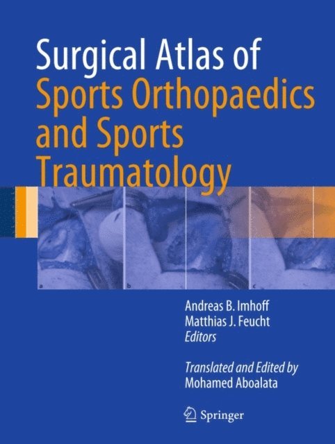 Matthias J. Feucht, Andreas B. Imhoff - Surgical Atlas of Sports Orthopaedics and Sports Traumatology, E-bok