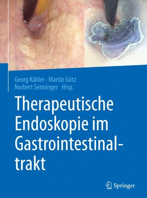 Norbert Senninger, Martin Gotz, Georg Kahler - Therapeutische Endoskopie im Gastrointestinaltrakt, E-bok