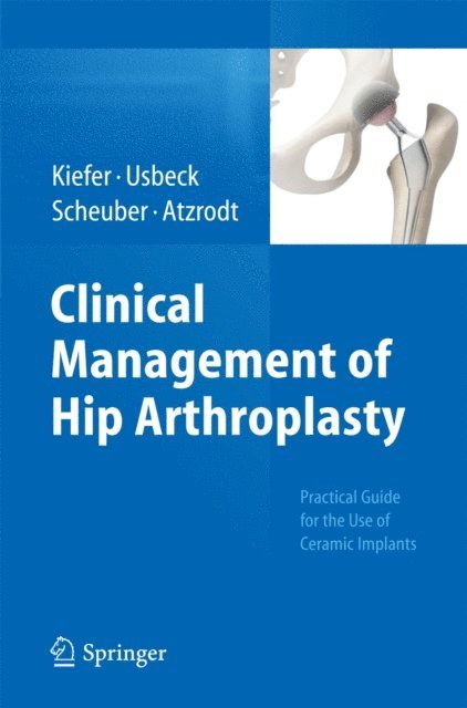 Hartmuth Kiefer - Clinical Management of Hip Arthroplasty, E-bok