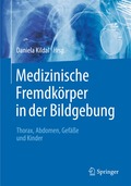 Medizinische Fremdk�rper in der Bildgebung