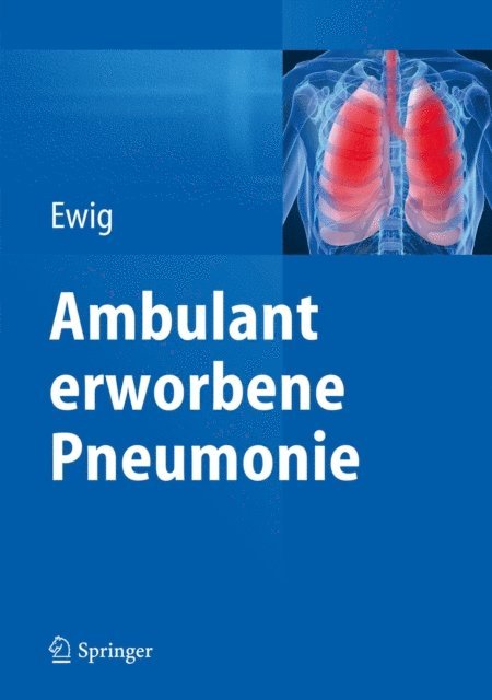 Santiago Ewig - Ambulant erworbene Pneumonie, E-bok