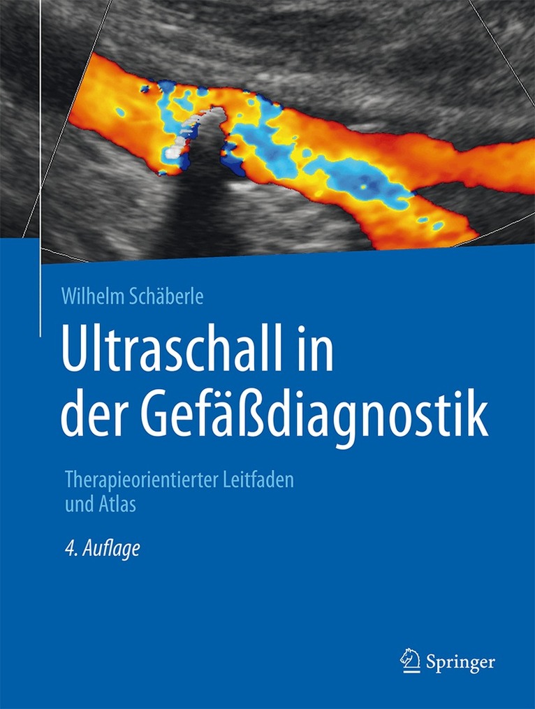 Wilhelm Schäberle - Ultraschall in der Gefäßdiagnostik, Inbunden