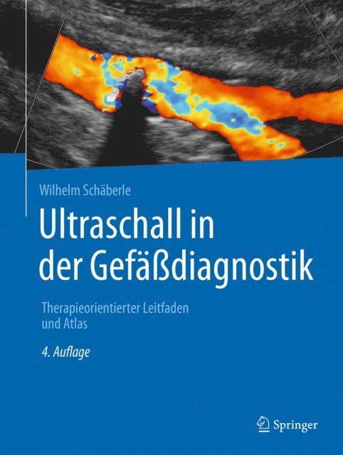 Wilhelm Schaberle - Ultraschall in der Gefäßdiagnostik, E-bok. Tillgänglighet: Lägg i varukorg