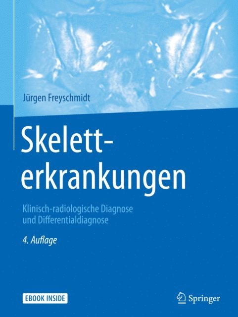 Jurgen Freyschmidt - Skeletterkrankungen, E-bok