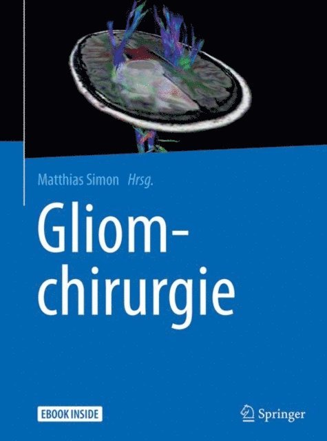 Matthias Simon - Gliomchirurgie, E-bok