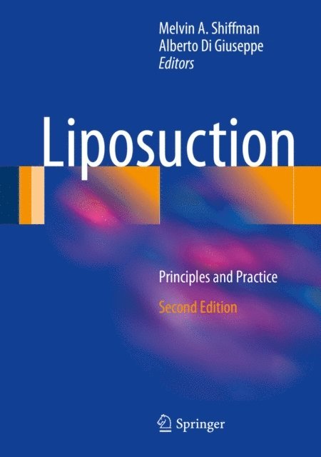 Alberto Di Giuseppe, Melvin A. Shiffman - Liposuction, E-bok