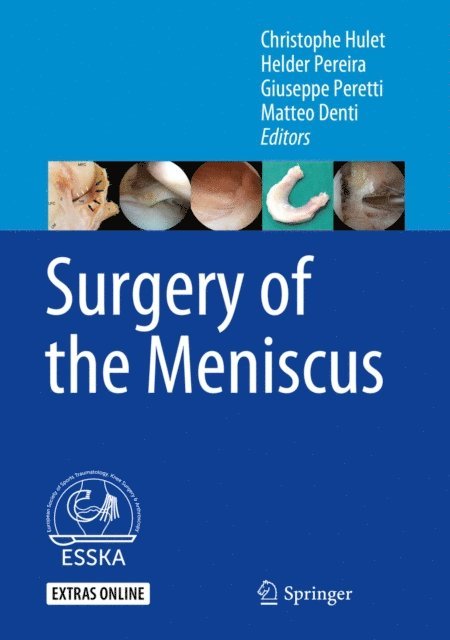 Matteo Denti, Giuseppe Peretti, Helder Pereira, Christophe Hulet - Surgery of the Meniscus, E-bok