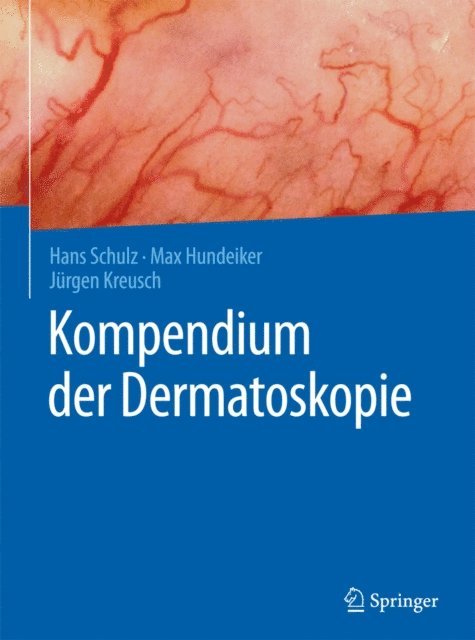 Jurgen Kreusch, Max Hundeiker, Hans Schulz - Kompendium der Dermatoskopie, E-bok