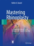 Mastering Rhinoplasty