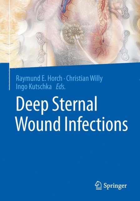 Ingo Kutschka, Christian Willy, Raymund E. Horch - Deep Sternal Wound Infections, E-bok