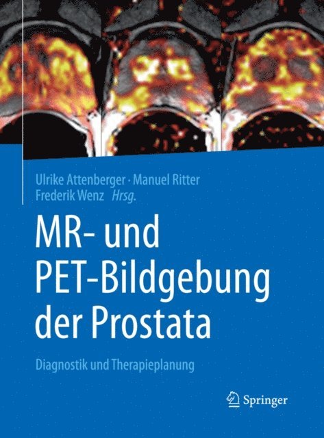Frederik Wenz, Manuel Ritter, Ulrike Attenberger - MR- und PET-Bildgebung der Prostata, E-bok