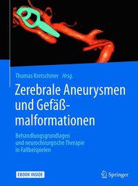 Zerebrale Aneurysmen und Gefäßmalformationen