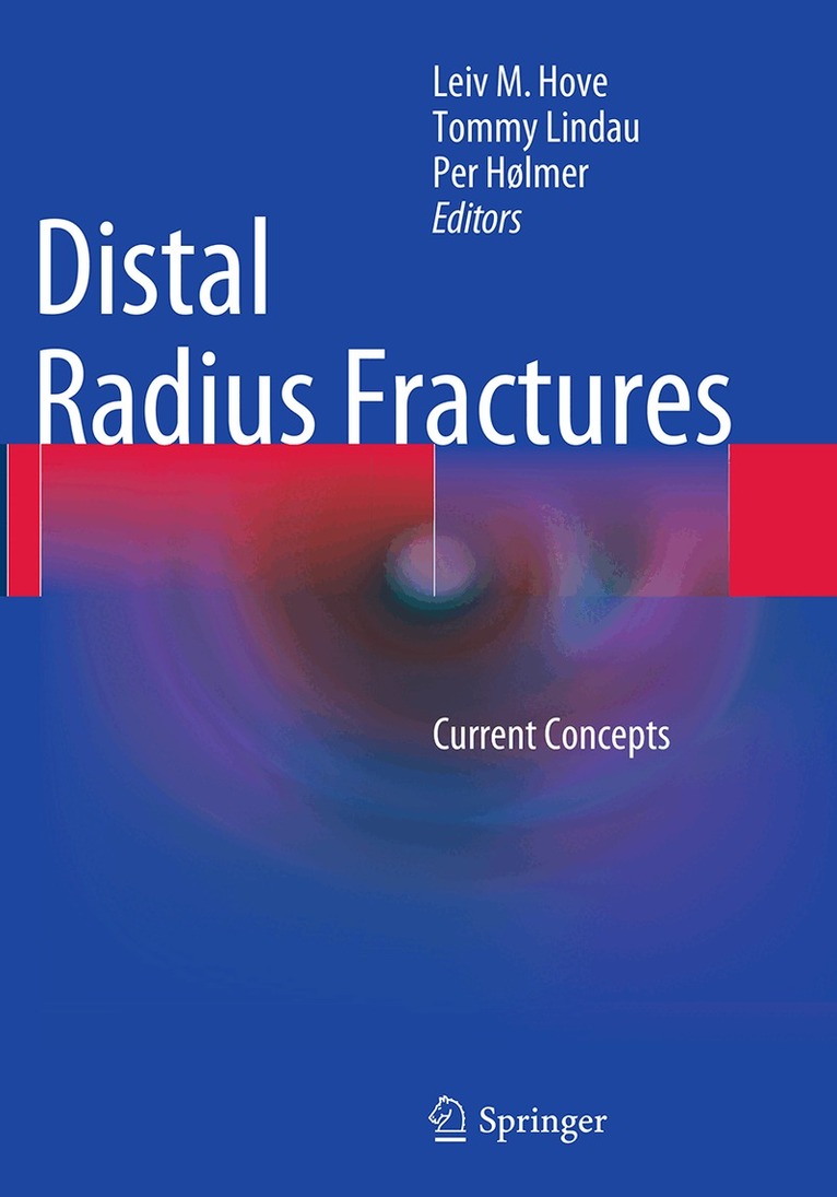 Leiv M. Hove, Tommy Lindau, Per Hølmer - Distal Radius Fractures, Häftad