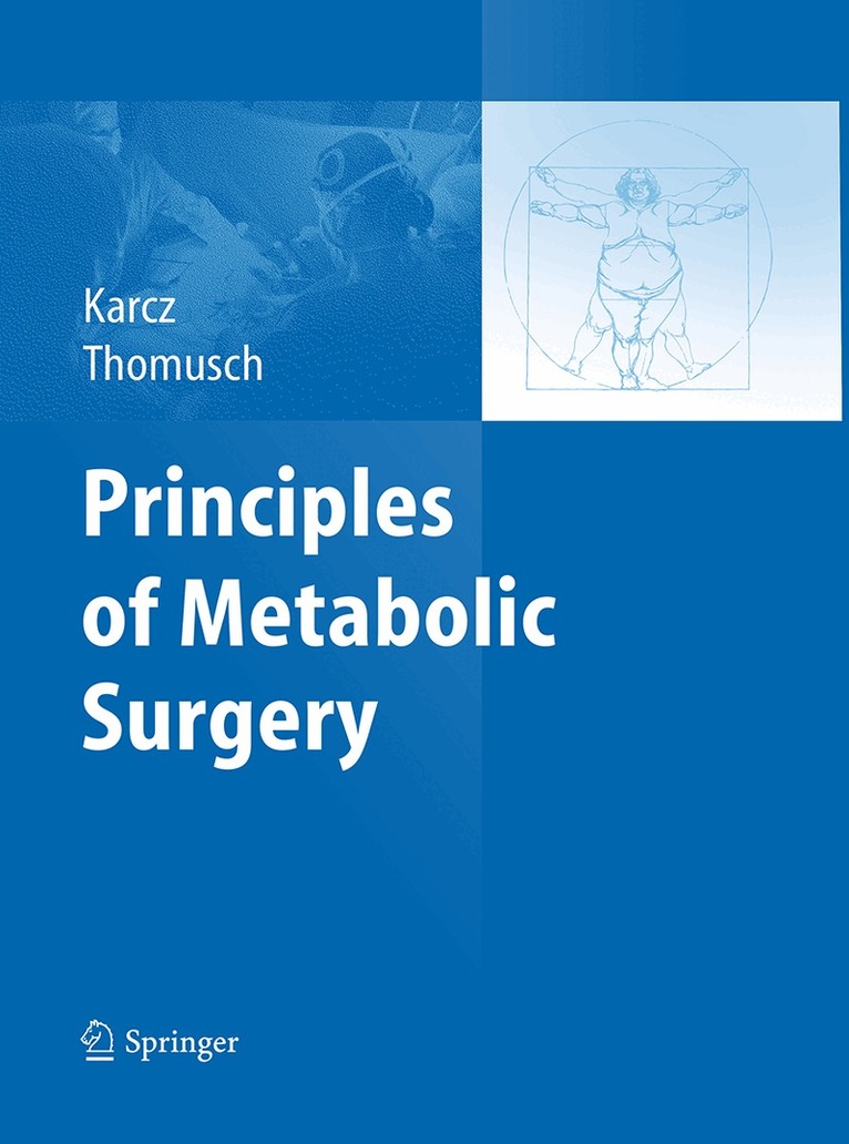 Konrad Karcz, Oliver Thomusch - Principles of Metabolic Surgery, Häftad