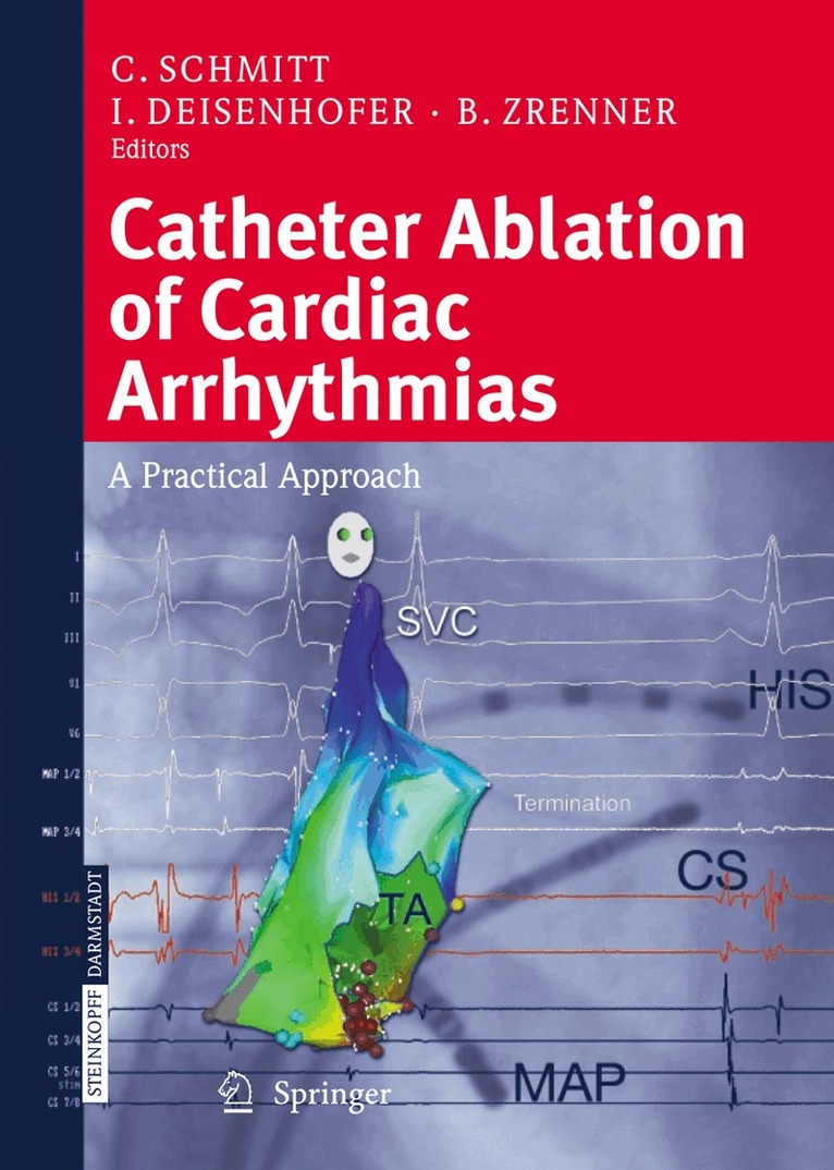 C. Schmitt, I. Deisenhofer, B. Zrenner - Catheter Ablation of Cardiac Arrhythmias, Häftad