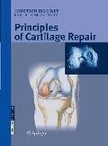 Principles of Cartilage Repair